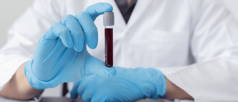 Jak interpretować badania krwi i dlaczego normy to nie wszystko