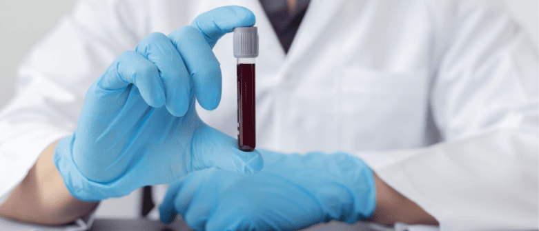 Jak interpretować badania krwi i dlaczego normy to nie wszystko